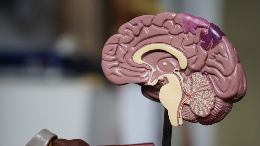 Brain-scaled