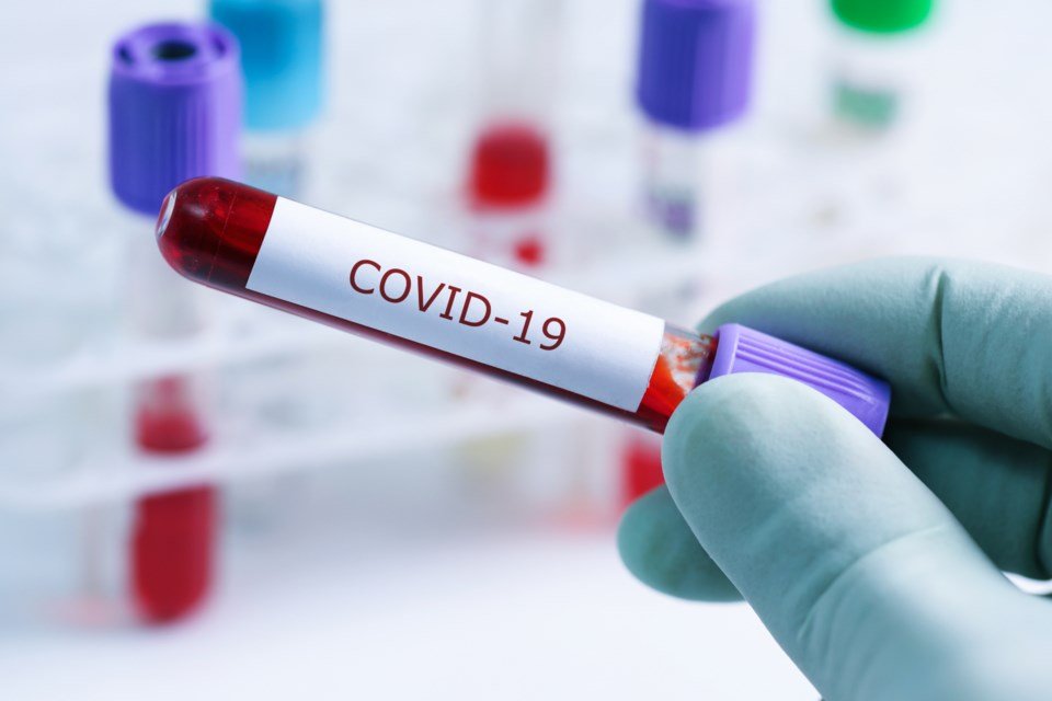 covid-19
